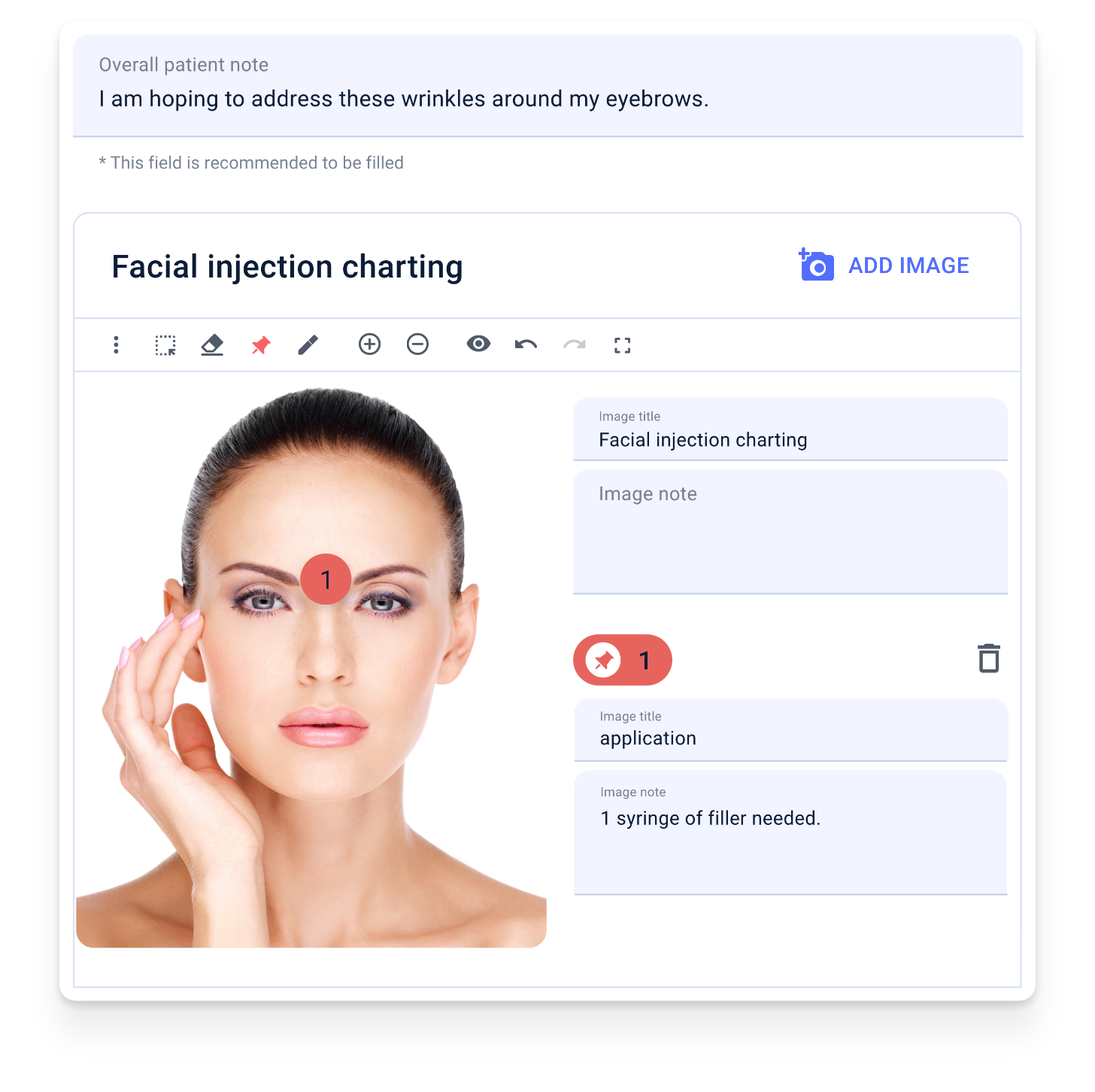 Hero Image - Facial Injection Charting