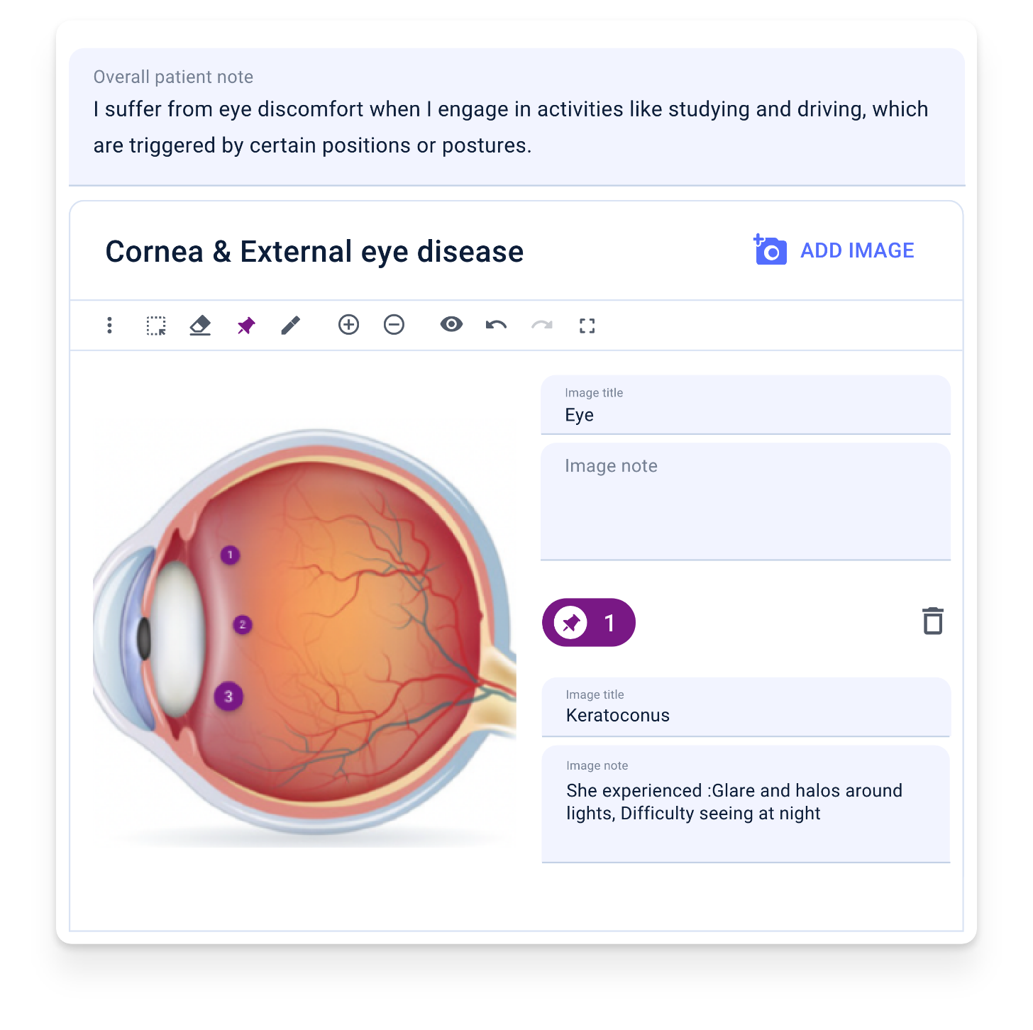 Optometry